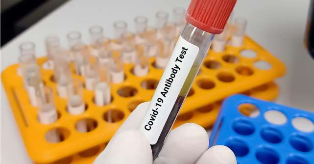 Testele pentru depistarea anticorpilor anti SARS-CoV-2: De câte tipuri sunt, când și de ce se utilizează