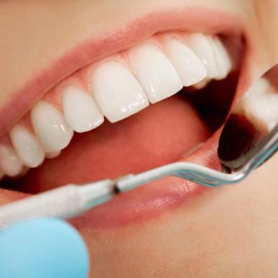 Implantul Dentar: tot ce ar trebui sa stii