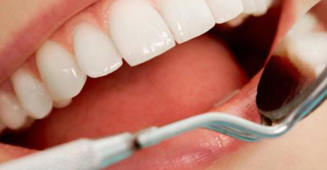 Implantul Dentar: tot ce ar trebui sa stii