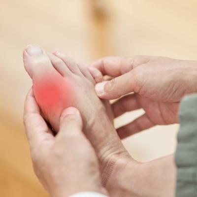 Guta, un diagnostic des întâlnit. Simptome și Tratament