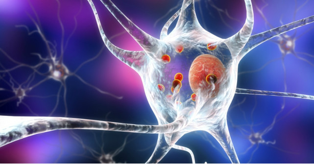 Totul despre boala Parkinson: simptome, cauze si tratament