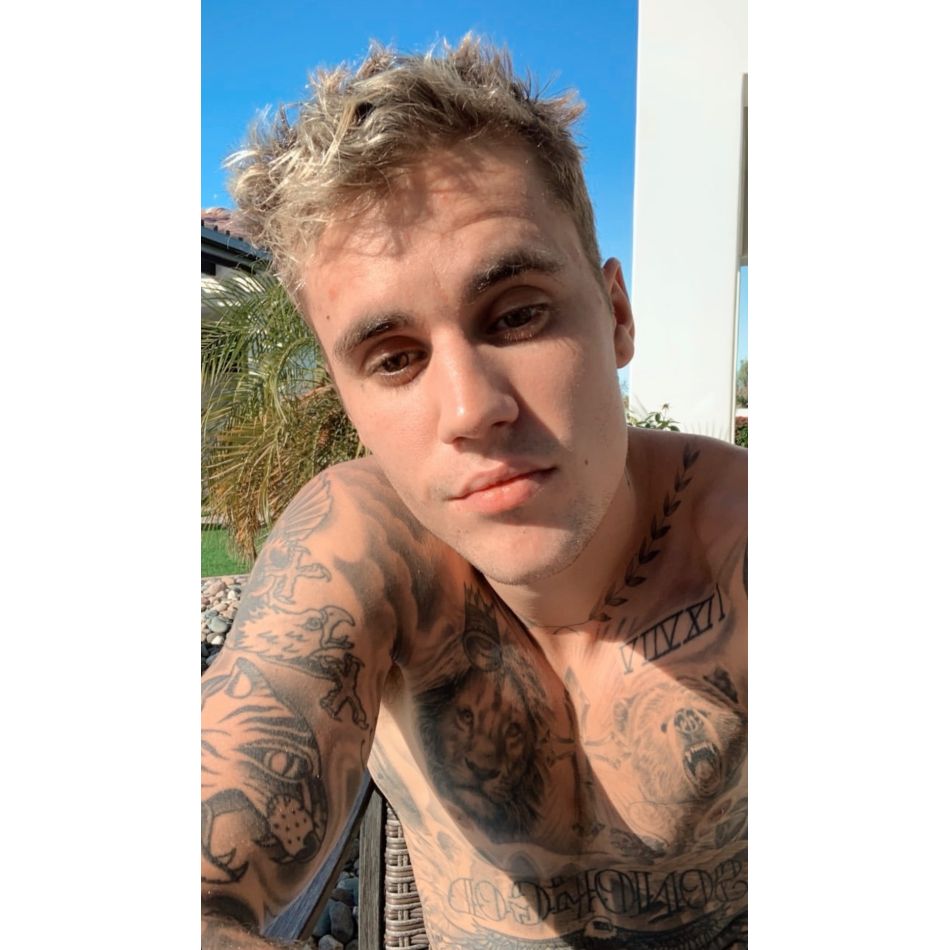 Justin Bieber, noi detalii despre starea sa de sănătate. Artistul a rămas paralizat pe partea dreaptă a feței