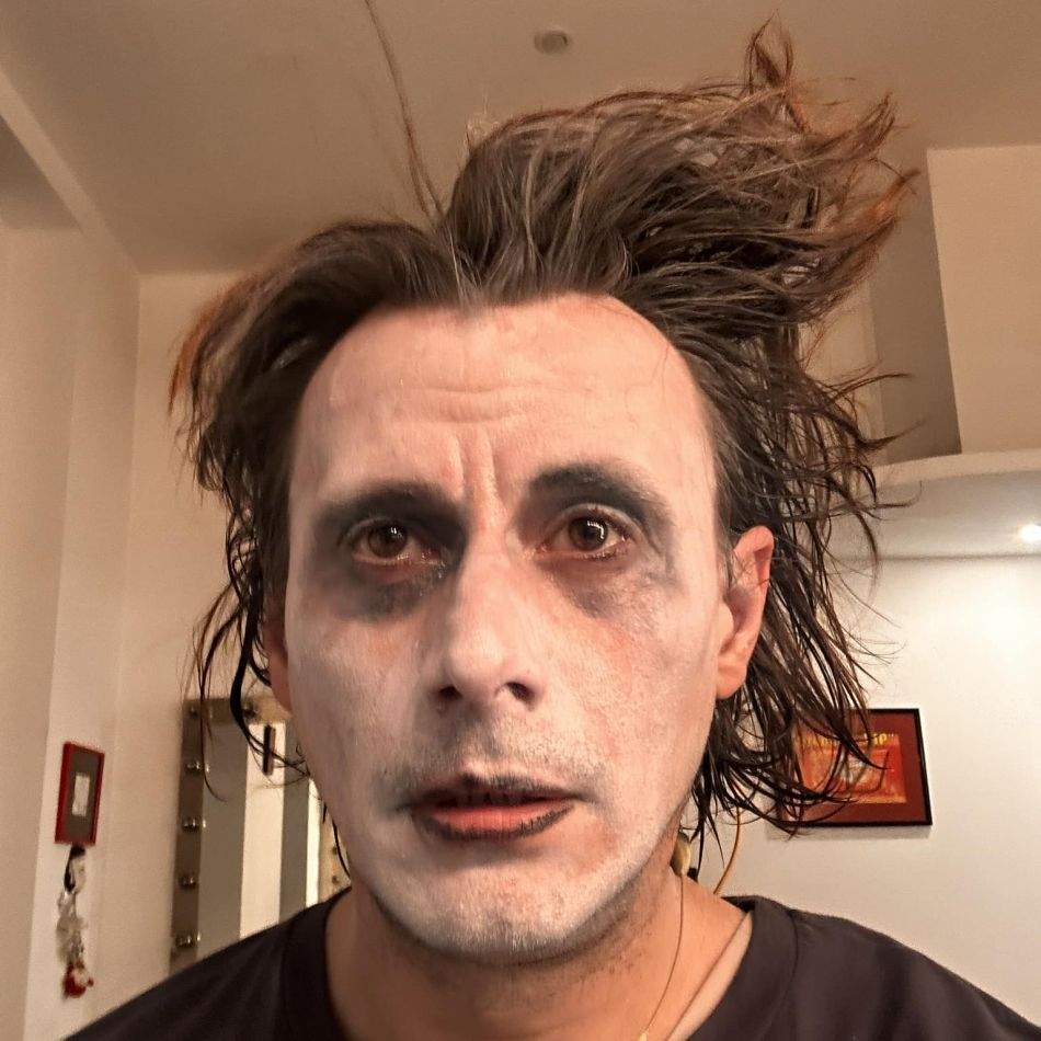 Marius Manole s-a accidentat pe scenă. Actorul a fost transportat de urgență la spital