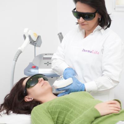 Epilarea defintiva pe intelesul tuturor