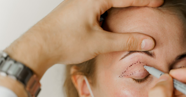 Intervenții de chirurgie estetică: transformări remarcabile în lupta împotriva îmbătrânirii