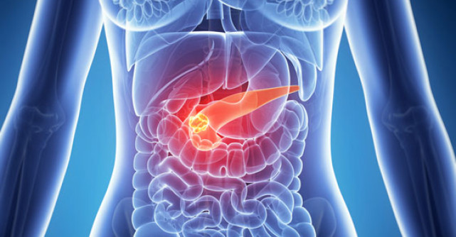 Cum sa NU faci pancreatita acuta de sarbatori