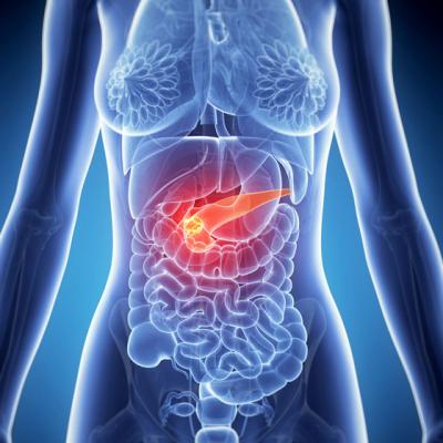 Cum sa NU faci pancreatita acuta de sarbatori