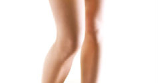 3 lucruri pe care trebuie sa le stii despre insuficienta venoasa