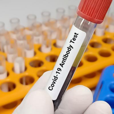Testele pentru depistarea anticorpilor anti SARS-CoV-2: De câte tipuri sunt, când și de ce se utilizează