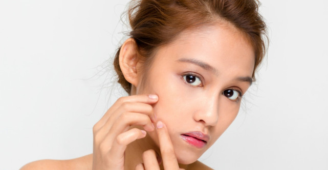 Cele mai sanatoase metode de a scapa de acnee