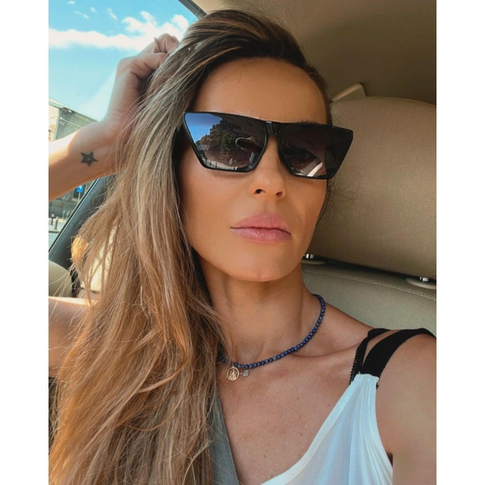 Flavia Mihășan a apelat la medicul estetician pentru a-și tăia pleoapele. Cum se simte acum vedeta?