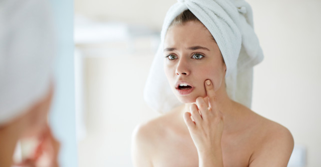 Tot ce trebuie sa stii despre acnee