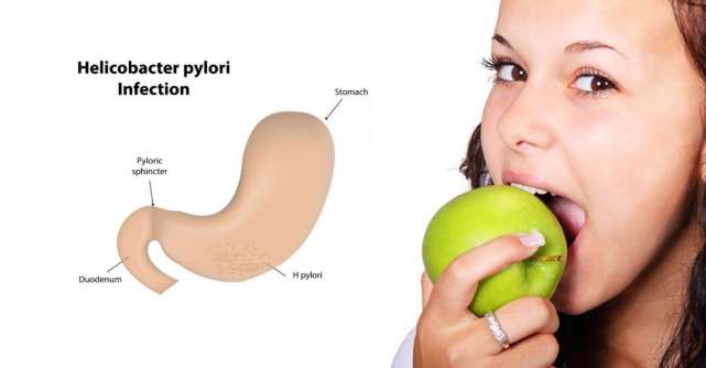 Helicobacter Pylori - simptome si tratament
