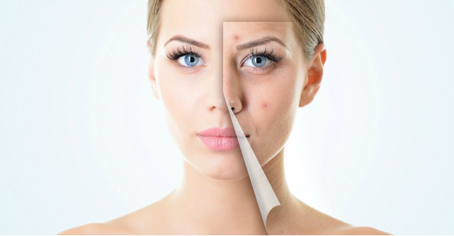 3 proceduri dermatocosmetice recomandate in aceasta toamna pentru o piele radianta