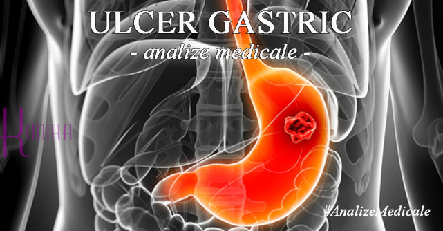 Analize medicale pentru ULCERUL GASTRIC