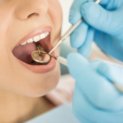 3 secrete care te feresc de urgența stomatologică