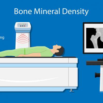 Tot ce trebuie să știi despre Osteodensitometrie (DXA): când este recomandată și pentru ce?