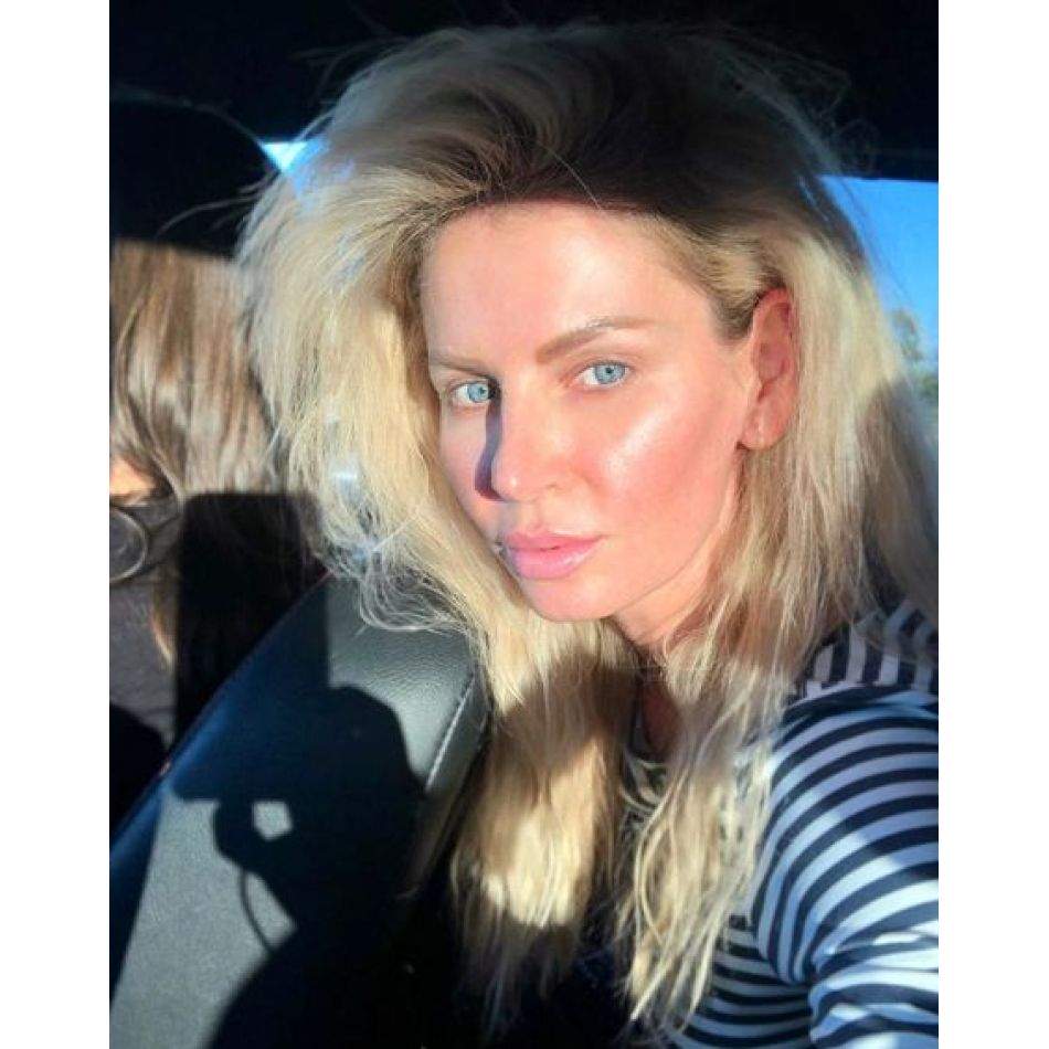 Andreea Bănică a revenit la medicul estetician! Ce schimbare și-a făcut artista la nivelul feței?