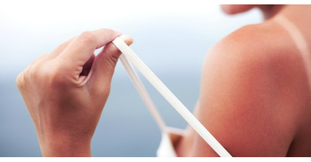 10 remedii naturale pentru calmarea arsurilor solare