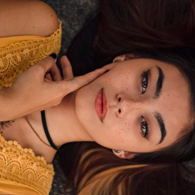 Iată cum poți scăpa de petele pigmentare! 