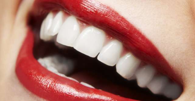 Totul despre albirea dentara: Secretul unui zambet de milioane