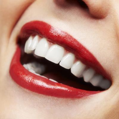 Totul despre albirea dentara: Secretul unui zambet de milioane