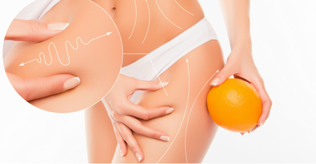 Cum să scapi de celulită: radiofrecvența, tratamentul-minune!