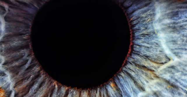 Ochii sunt oglinda SANATATII! 10 afectiuni care pot fi citite in ochi