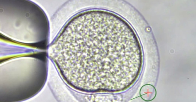 Poti evita transmiterea unor boli ereditare prin diagnosticul genetic preimplantational
