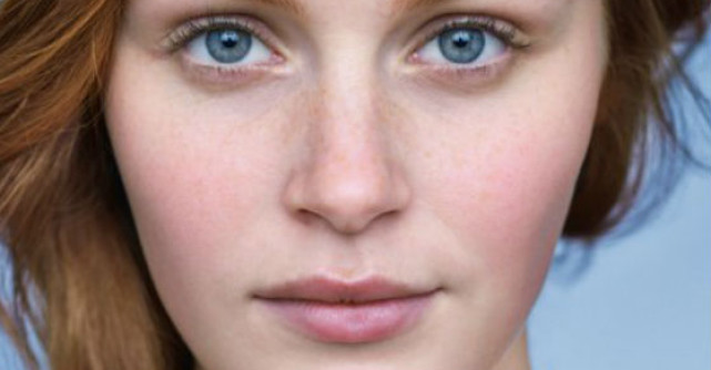 Combate roseata direct de la sursa