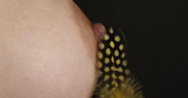 Un nou medicament pentru tratarea cancerului de san