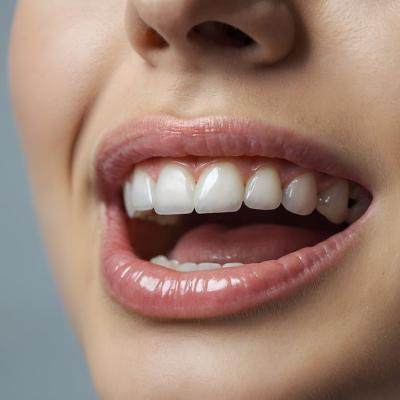 Tratamentul Guided Biofilm Therapy (GBT) - o soluție inovatoare de igienizare dentară