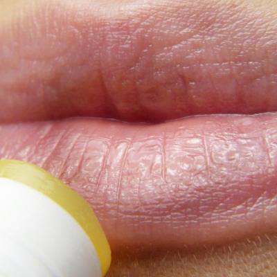 De ce ai tot timpul buzele crăpate și cum le poți vindeca rapid