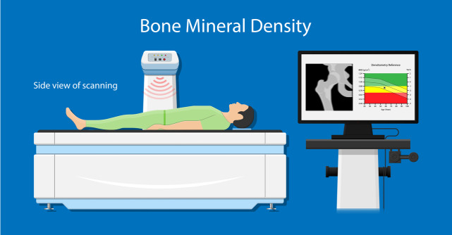 Tot ce trebuie să știi despre Osteodensitometrie (DXA): când este recomandată și pentru ce?