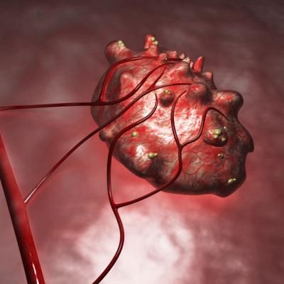 Chisturile ovariene duc la infertilitate? Dar chisturile endometriozice?