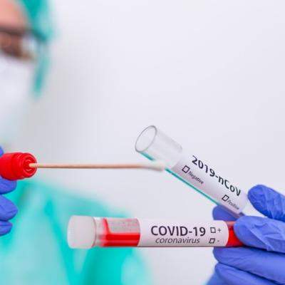 Tot ce trebuie să știi despre testele pentru COVID-19: care sunt acestea, când și cum se pot efectua