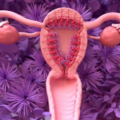 Endometrioza, doar o boală modernă? Adevărul despre cauze, simptome și infertilitate + posibile tratamente