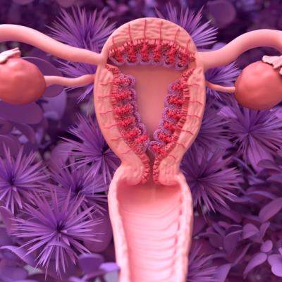 Endometrioza, doar o boală modernă? Adevărul despre cauze, simptome și infertilitate + posibile tratamente