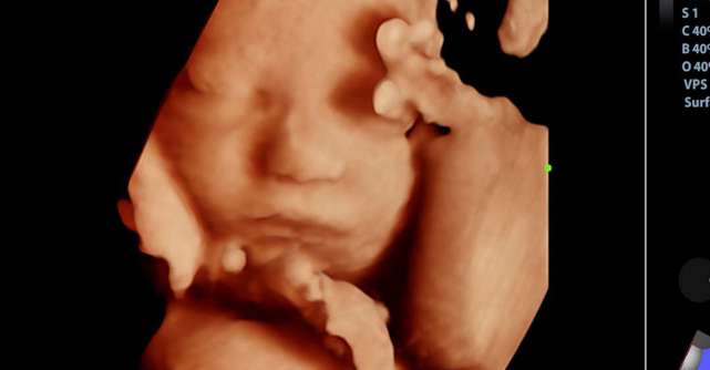 Ecografiile de morfolgie fetală 3D/4D: ce ar trebui să știe viitoarea mămică?