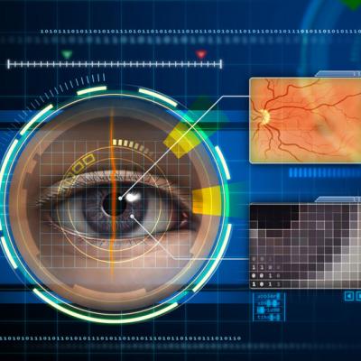 Scapa de ochelari cu cel mai precis LASER din lume