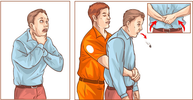 Manevra Heimlich: o manevra pe care oricine ar trebui sa o cunoasca