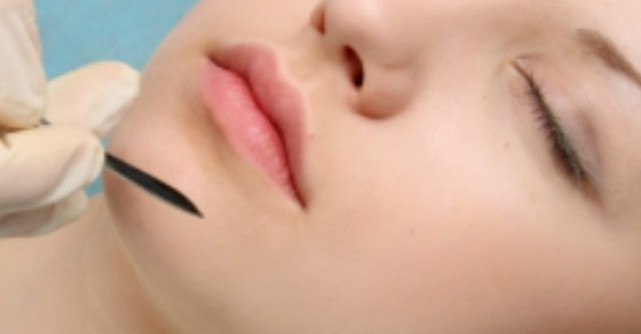 Mentoplastia - operatia de remodelare a barbiei 