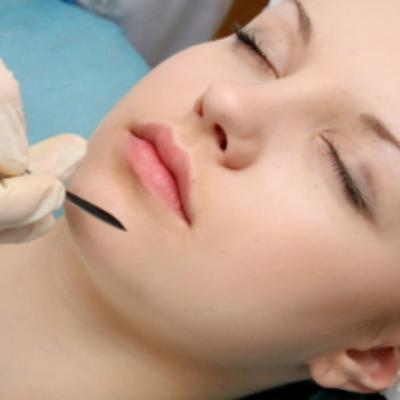 Mentoplastia - operatia de remodelare a barbiei 