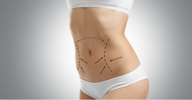 Lipoaspiratia, ca metoda de modelare a conturului corporal