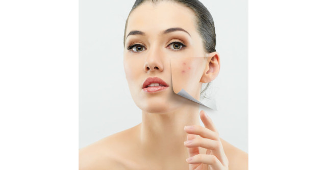 Spune-mi unde iti apar cosuri ca sa-ti spun de ce afectiuni suferi!