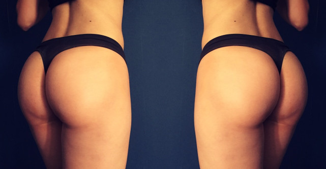 Fund bombat si fara celulita in doar UN MINUT? Iata ca se poate!