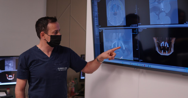 Premieră la Clinica 32. Primele implanturi Neodent ZiR, inserate cu succes prin ghidaj digital, fără tăieturi