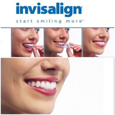 Invisalign - alternativa invizibila a aparatului dentar in Clinica Dr. Melnic