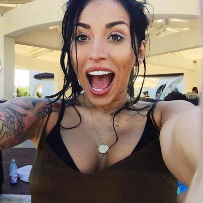 Ruby, plină din cap până în picioare de vânătăi! Cine a putut să îi facă așa ceva artistei?!