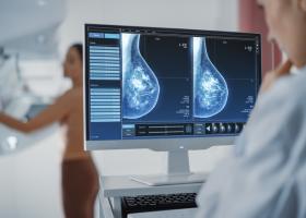 14 mituri și adevăruri despre cancerul mamar: Cine, cum și de ce poate face cancer de sân